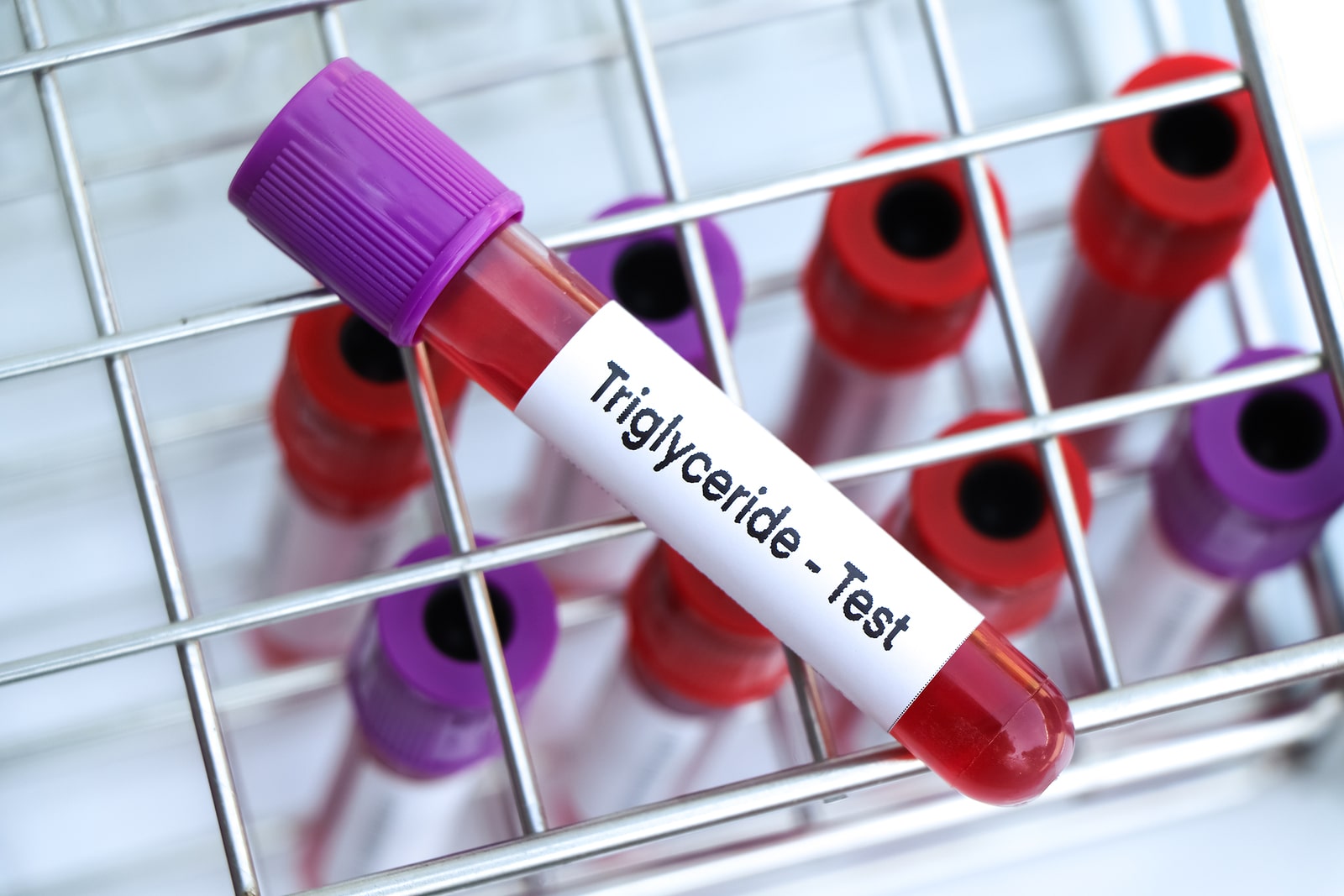 Triglycerides Elder Care San Francisco CA Home Care In San Francisco   Triglyceride Test To Look For Abnormalities From Blood Blood S