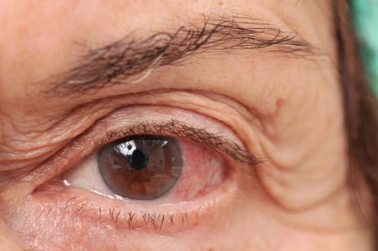 Home Care Assistance: Supporting Seniors with Diabetes and Eye Health